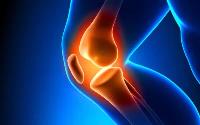 Focus on the knee – Patellofemoral Pain